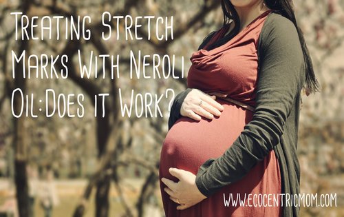 Treating Stretch Marks with Neroli Oil — Does it Work?